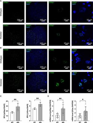 ROS scavengers decrease γH2ax spots in motor neuronal nuclei of ALS model mice in vitro